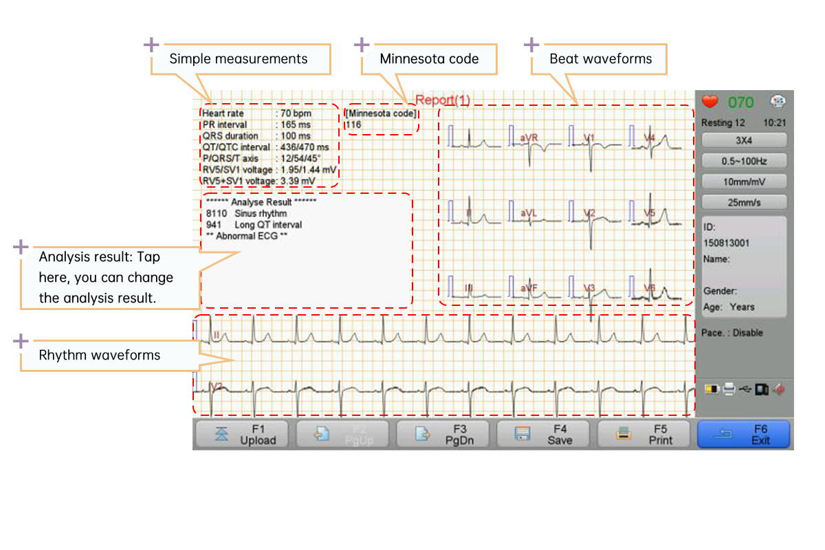 Análisis de ECG de asesoramiento para adultos y pediatría.