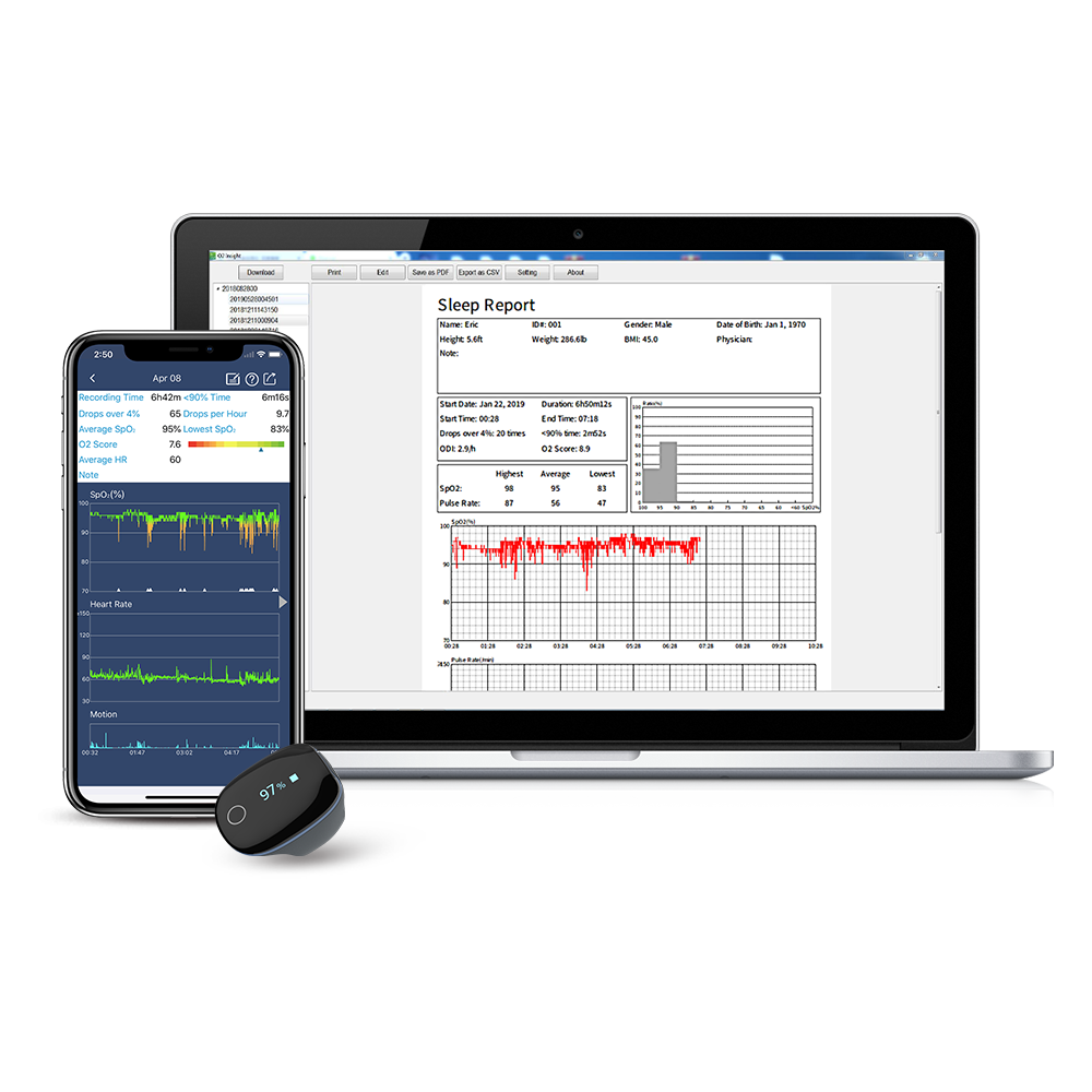 Wellue O2Ring Smart Ring Pulse Oximeter. Overnight Tracking. Wellue