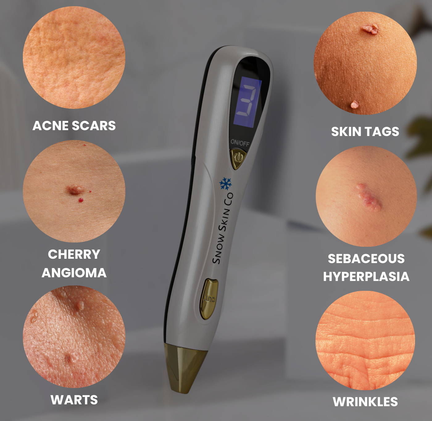 Best fibroblast plasma pen to buy, plasma pen for sale, plasma pen, fibroblast plasma pen, buy plasma pen, 