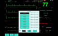 patient monitor with arrhythmia analyses