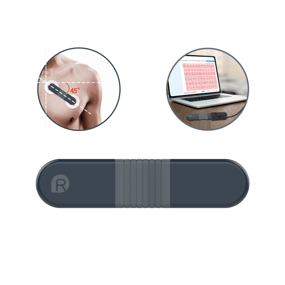 Fetal Heart Monitor Wellue