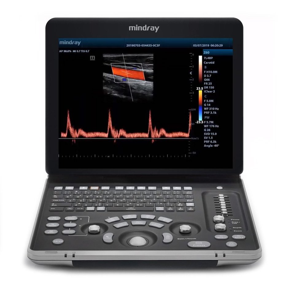 Portable Ultrasound machine Z60 Mindray , Color doppler, Probes; Linear + Convex 