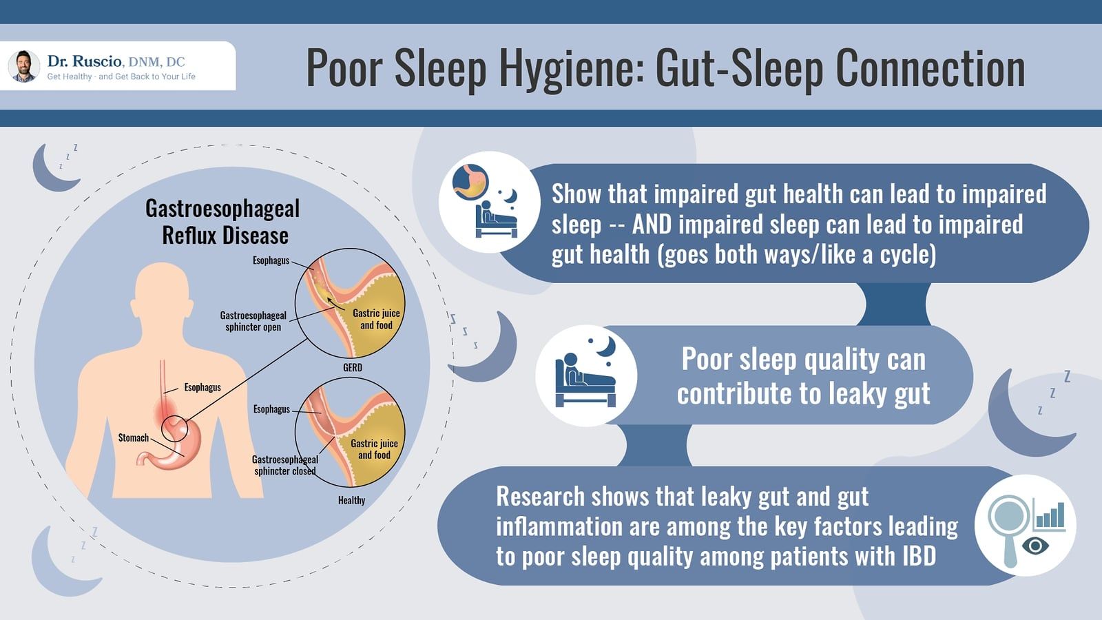 How to Make Meditation for Sleep Work for You -