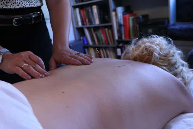 Person receiving acupuncture treatment on their back in a calm, book-filled therapy room.