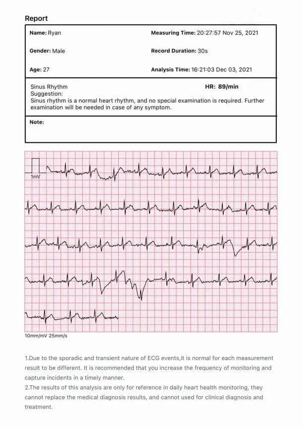 Digitales Blutdruckmessgerät mit EKG / EKG