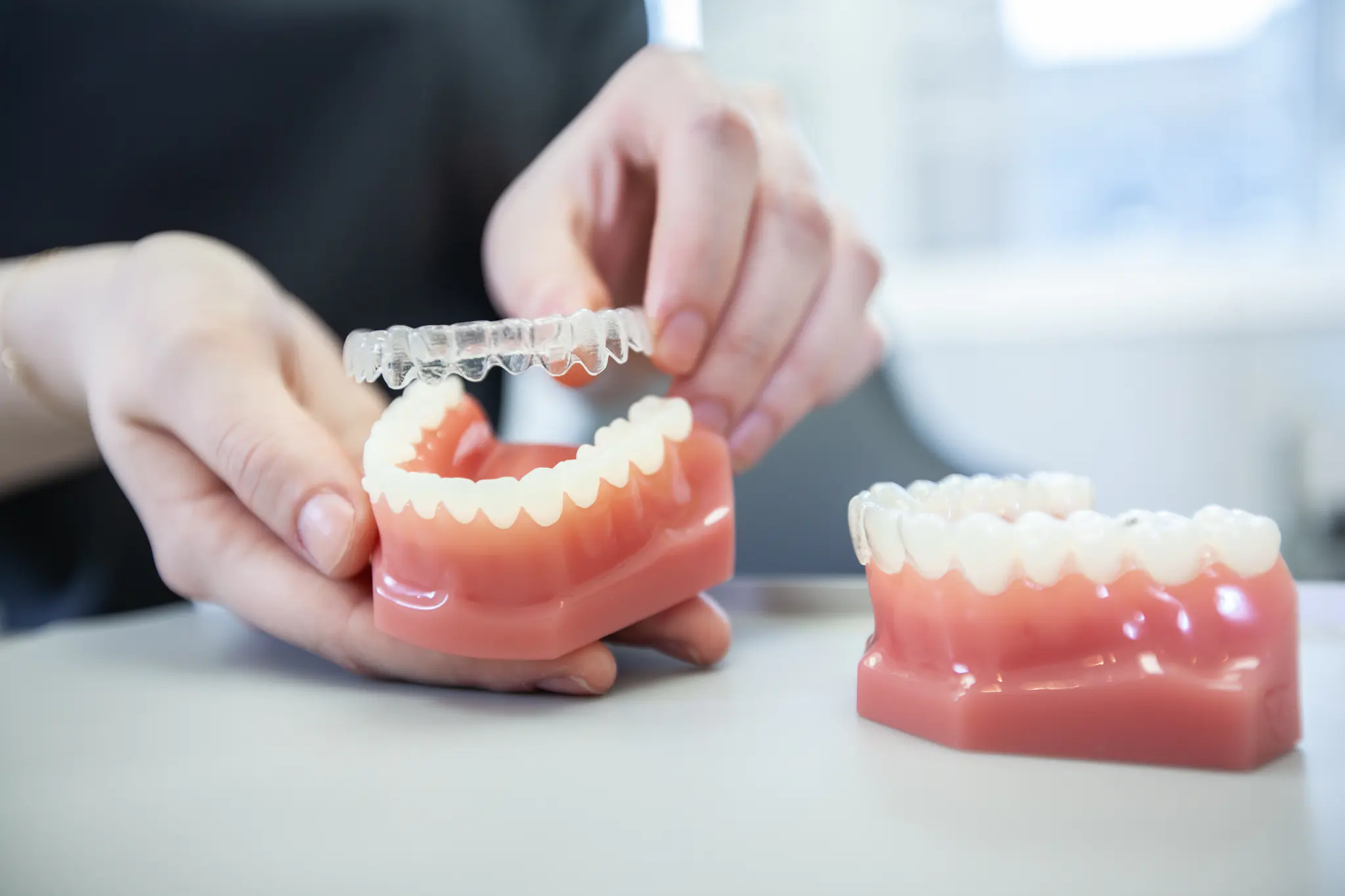 Aligner