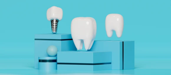 3D Implantologie: Zahnersatz sicher und modern geplant