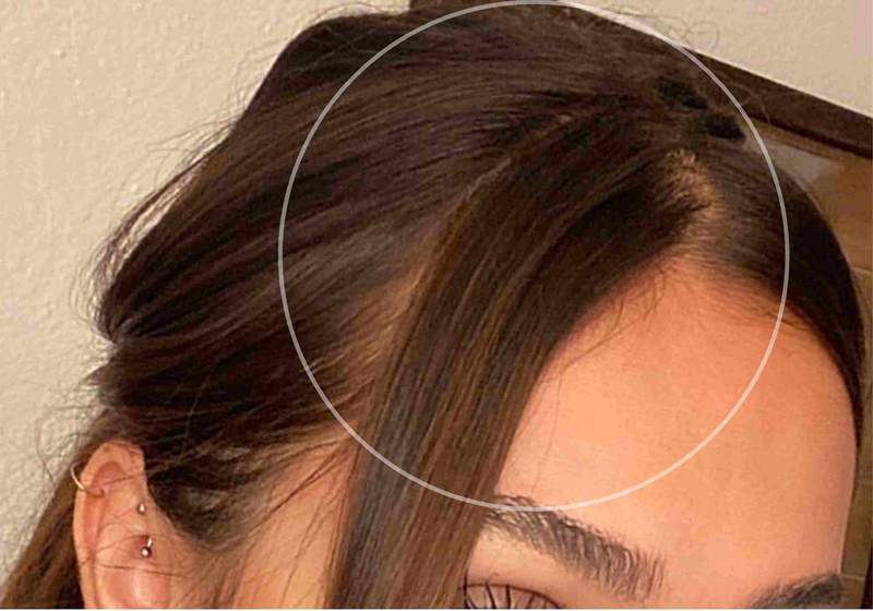 hair-skin-nails-before-after-results-pictures-photos