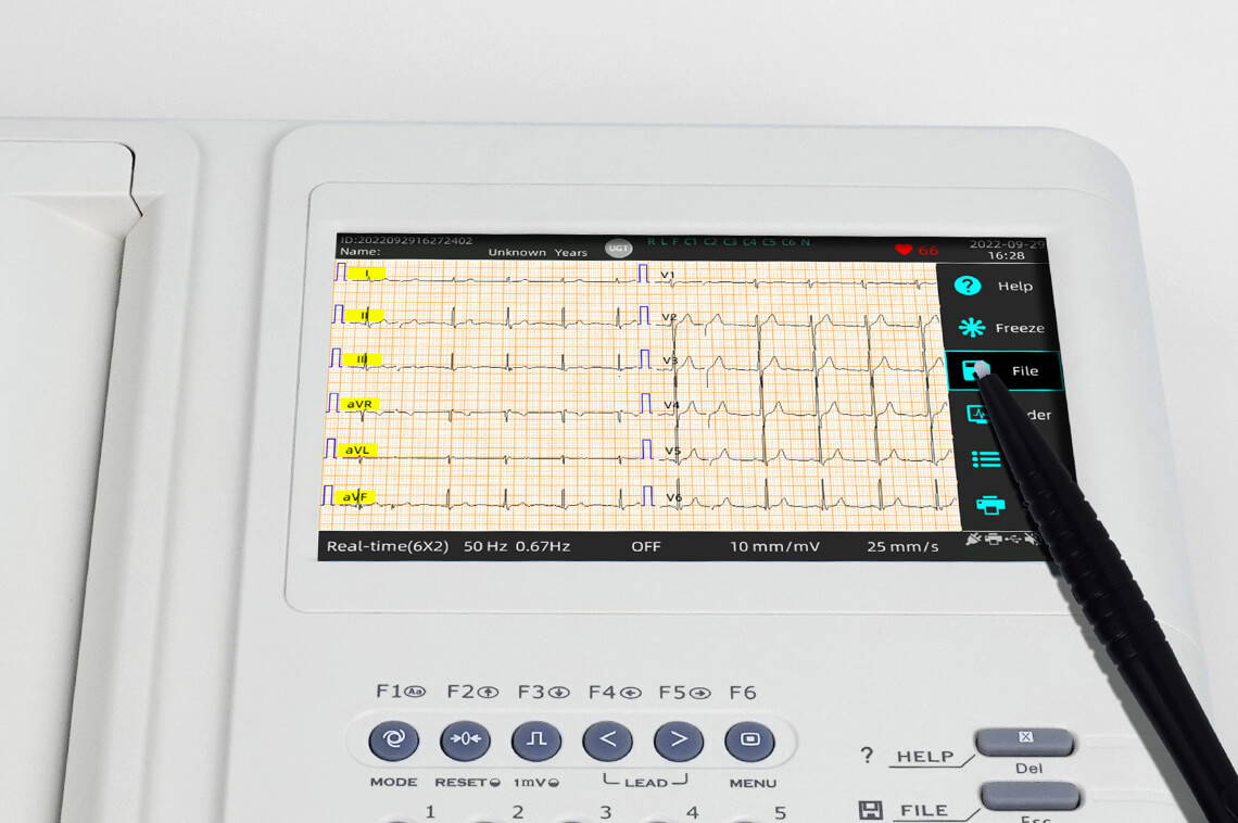 Das ECG1112 EKG-Gerät verfügt über einen Touchscreen mit Stift, um sekundenschnell direkte Befehle zu geben.