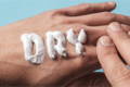 Very dry hands