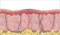 Thermal Diffusion Treatment