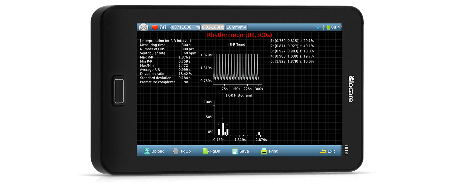 R-R analysis report