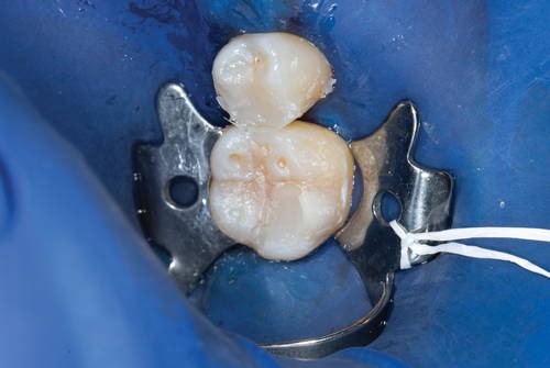 Restorations finalized