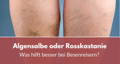 algensalbe oder rosskastanie