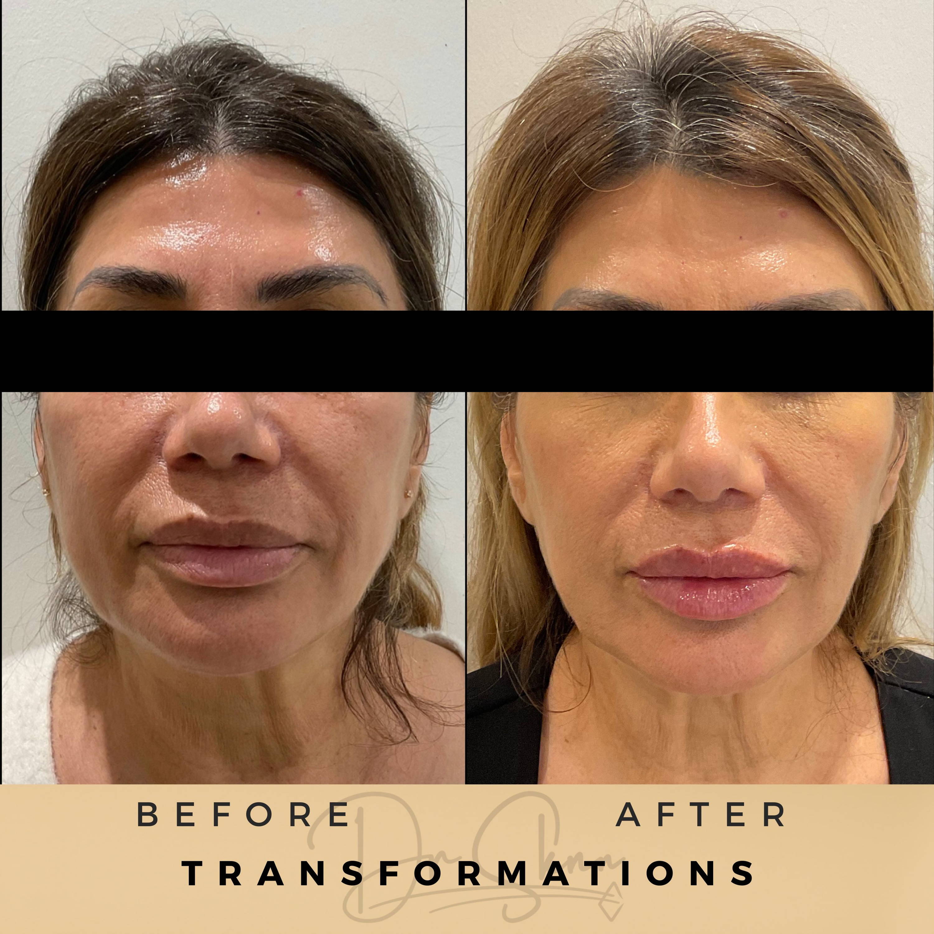 Transformations - Dr Sknn before and after
