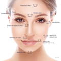 BOTOX injection sites and units used