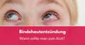 Schlecht geschlafen? Mit diesem Hausmittel verschwinden Augenringe in 10 Minuten! bindehautentzündung