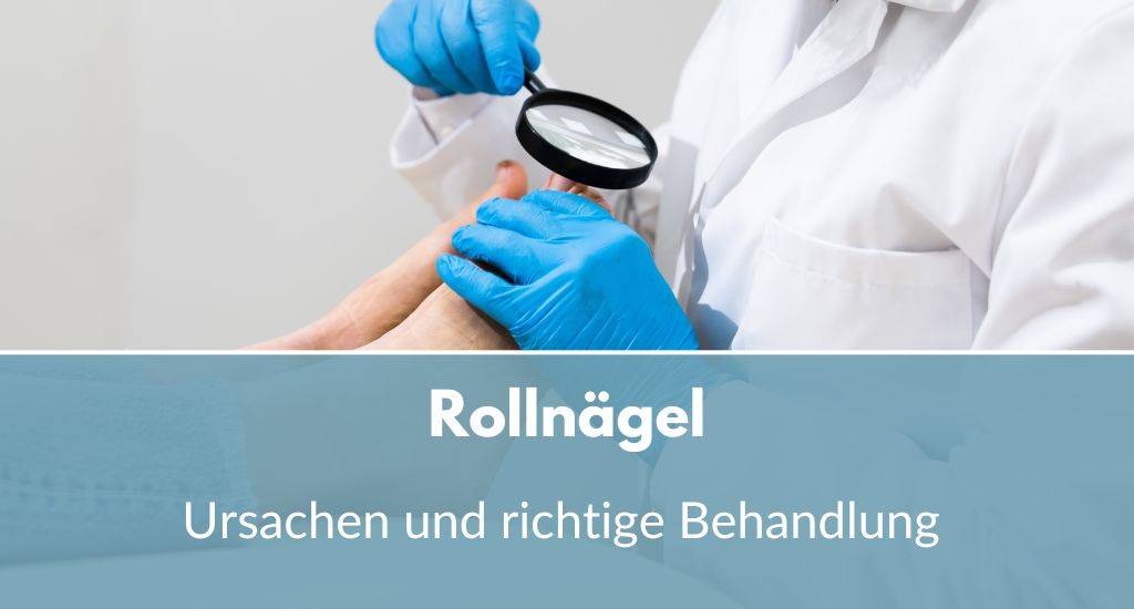 rollnägel