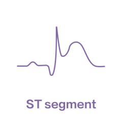 L'appareil ECG Biocare iE6 est sensible au diagnostic du segment ST