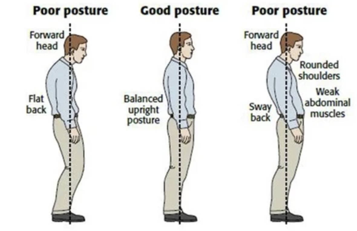 posture brace, back brace for posture, best posture corrector, posture corrector device, back posture corrector, back brace posture corrector