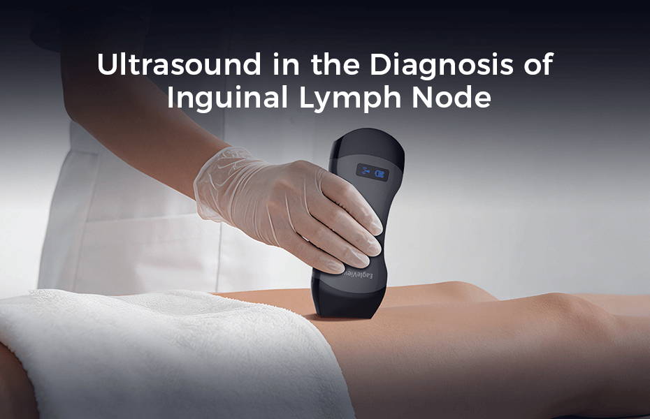 EagleView Portable Ultrasound in the Diagnosis of Inguinal Lymph Node