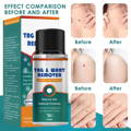 Tag & Wart Remover
