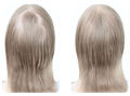 Before and after results of using our best vitamins for hair growth on a woman's head