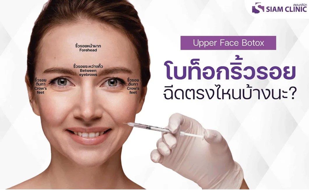 Jaw Reduction Botox Injection