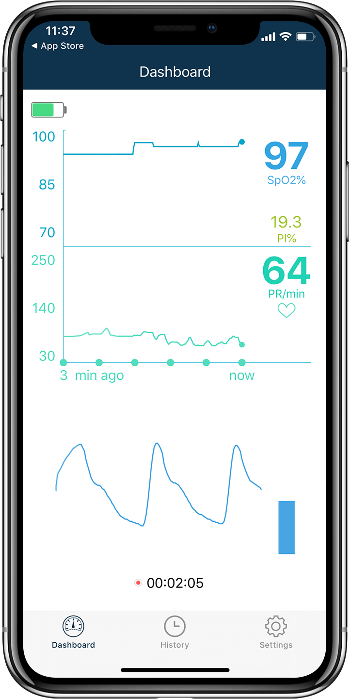 Wellue Oxysmart 손가락 맥박 산소 측정기 앱의 SpO2, 맥박수 추세 차트