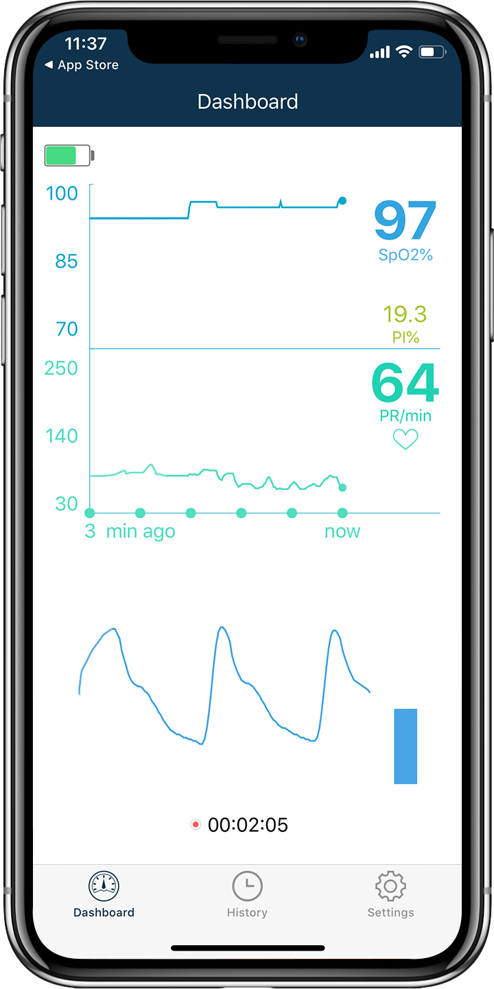 SpO2, gráficos de tendencia de la frecuencia del pulso en la aplicación del pulsioxímetro de dedo Wellue Oxysmart