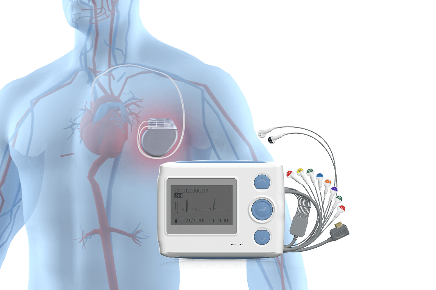 wellue 12-lead holter monitor with pacemaker detection