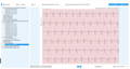 download the electrocardiogram (ecg/ekg)
