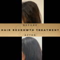 Hair Loss Treatment Dr Sknn Before & After Picture