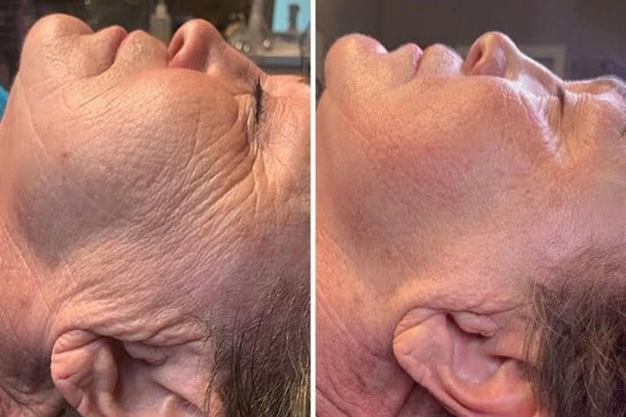 L&J Facial and Head Spa $10 Voucher - New Beith - Image 14